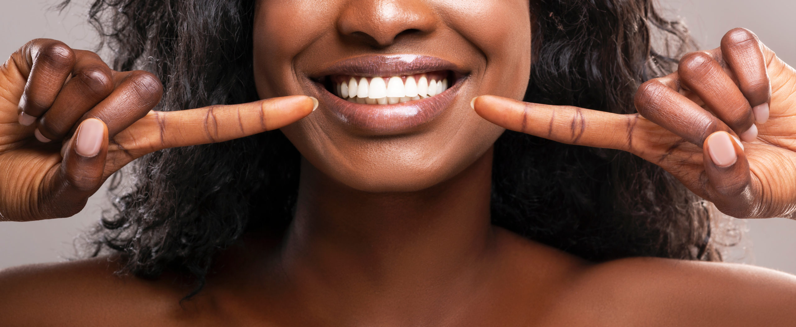 Free Teeth Whitening for New Patients