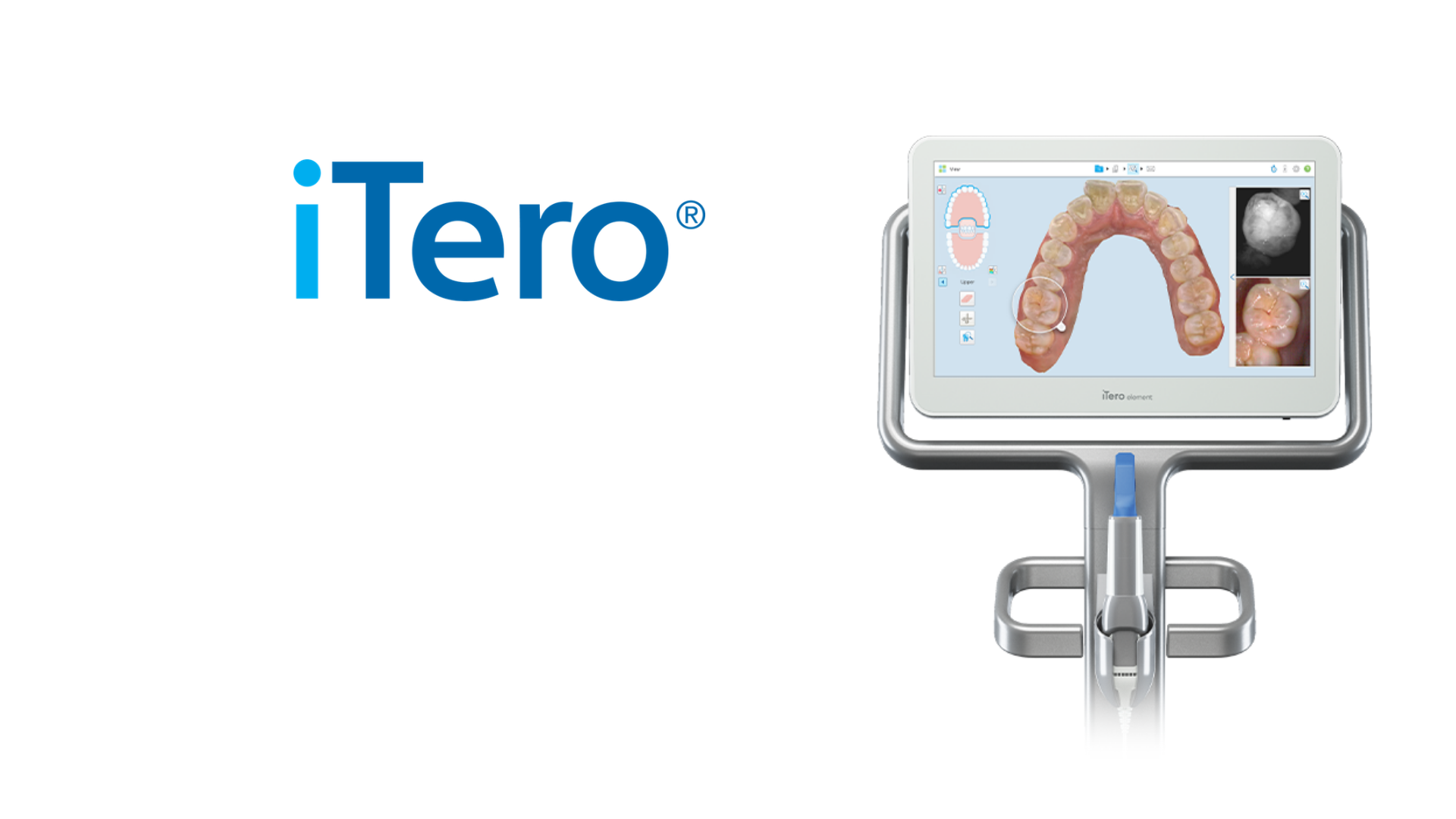 iTero Dental Scanner