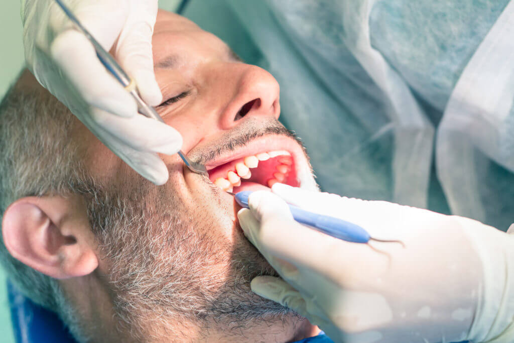 What Causes Plaque Buildup on Teeth?