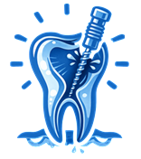 Root Canals