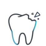 Emergency Chipped Tooth