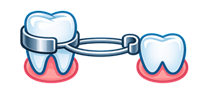 Band and Loop