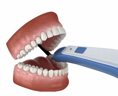invisalign how it works step 1